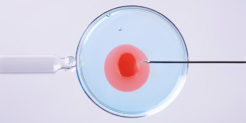 Reprodução Assistida